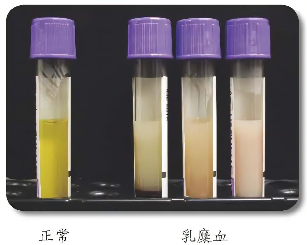 血浆质量机器视觉分级——从“人眼比色”到“毫秒级